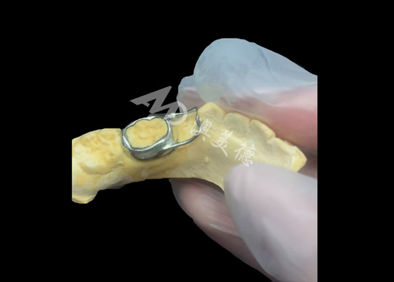 comprar O mantentor de espaço ortodôntico é um dispositivo inestimável que protege engenhosamente as lacunas dentárias das crianças, garantindo o desenvolvimento adequado dos dentes. online manufacture
