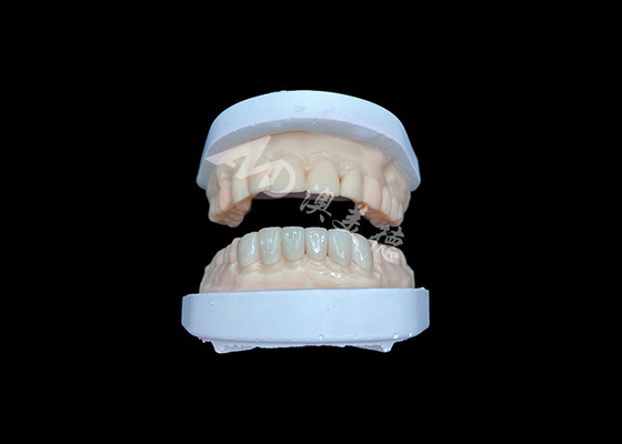 comprar IPS Emax Veneers Restaurações de aparência natural para sorrisos estéticos online manufacture