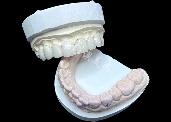 comprar IPS e.max Veneers na sombra BL2 alcançar uma estética natural impressionante com 8 unidades perfeitamente fabricadas online manufacture