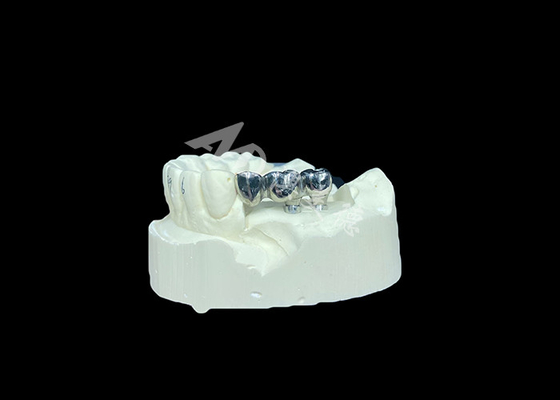 comprar Implante dentário de coroa de titânio de longo prazo para substituição de dentes perdidos online manufacture