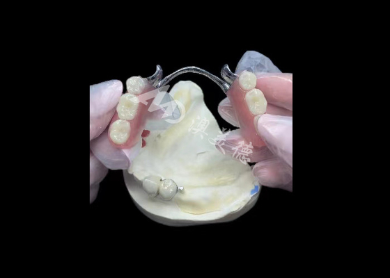 comprar Porcelana durável fundida a metal coroa dental PFM coroa para restauração online manufacture