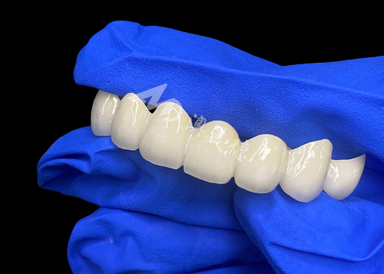 comprar Lava de alta translucidez Zirconia ponte dental mistura sem costura com dentes naturais online manufacture