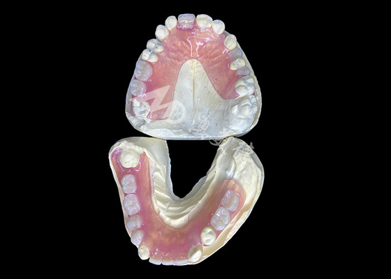 comprar Dentadura parcial flexível Valplast para máximo conforto e apelo estético online manufacture