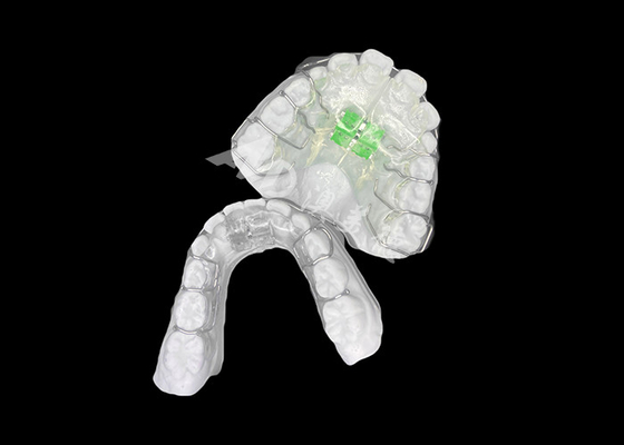 comprar Expansor de ortodoncia removível eficaz para um alinhamento óptimo da mandíbula e saúde dental online manufacture