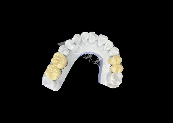 comprar Coroa dental de porcelana de zircônio PFZ do laboratório dental profissional da China online manufacture