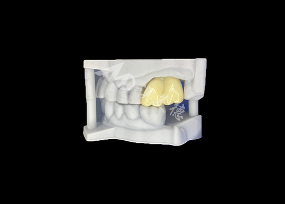 comprar Coroa dental de zircônio sólido Durabilidade garantida Molar do laboratório dentário da China online manufacture