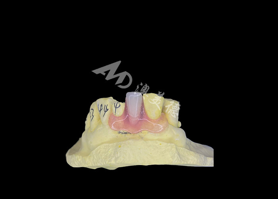 comprar Dentadura parcial flexível da Nesbit para conforto e durabilidade na substituição dentária online manufacture