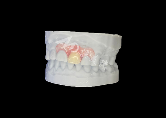 comprar Dentadura parcial flexível Nesbit personalizada para ajuste natural e conforto duradouro online manufacture