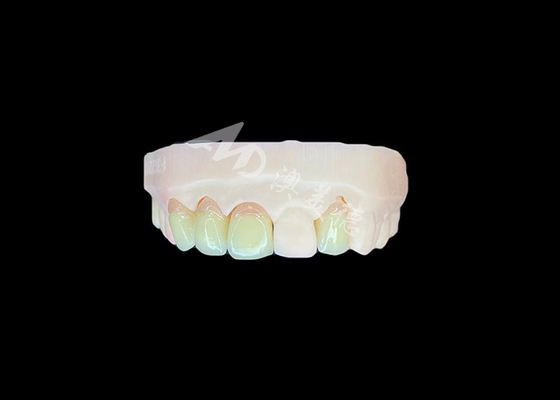 comprar Natural e confortável Fit Zirconia porcelana coroa China laboratório dentário sombra personalizável online manufacture