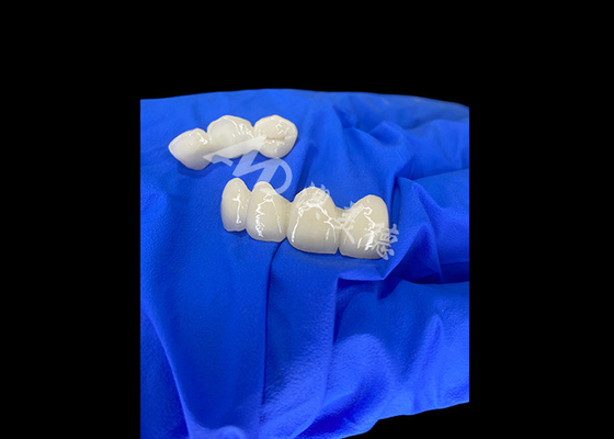 comprar Wieland Zenostar Ceramic Crown Bridge Alta precisão para restaurações duradouras e de aparência natural online manufacture