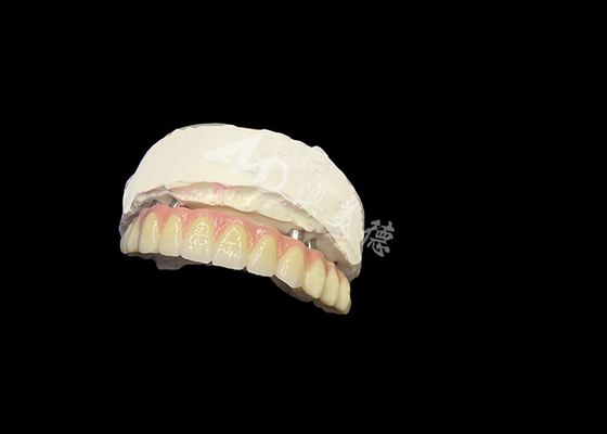 comprar Dentes dentários implantados Estabilidade Conforto e sorriso natural online manufacture