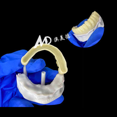 comprar Ponte de implante provisória de PMMA com interior oco para estabilidade e cura natural, fabricação CAD/CAM de alta precisão, material PMMA biocompatível online manufacture
