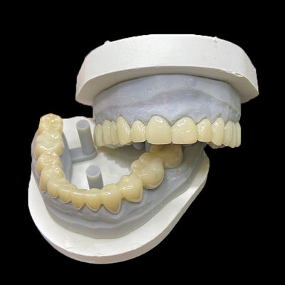 comprar PMMA Restaurações temporárias CAD/CAM PMMA Coroas e pontes para caixas dentárias provisórias online manufacture