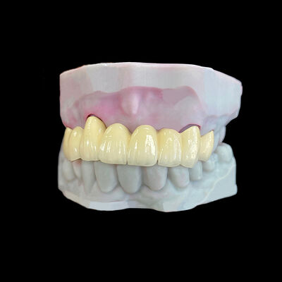 comprar Coroa de Porcelana Fundida em Metal (PFM) com Estrutura de Co-Cr online manufacture