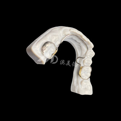 comprar Arco Lingual Personalizado com Bandas Aparelho Ortodôntico para Manutenção de Espaço e Alinhamento Dental online manufacture