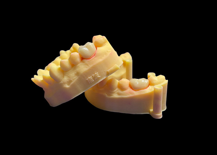 Coroa dental de porcelana de zircônio de qualidade superior Força inigualável Precisão de ajuste e estética e durabilidade excepcionais