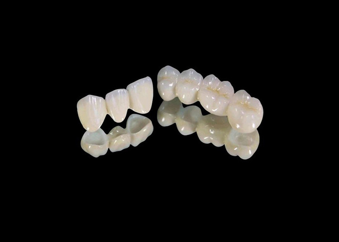 Coroa dental de zircônio resistente ao desgaste com resistência a escoriações e manchas e estética natural do laboratório dentário da China