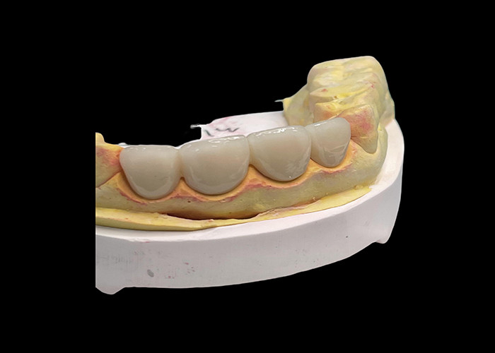 Resistente ao desgaste resistente à duração toda a ponte de coroa de cerâmica com excelente biocompatibilidade para restauração dental