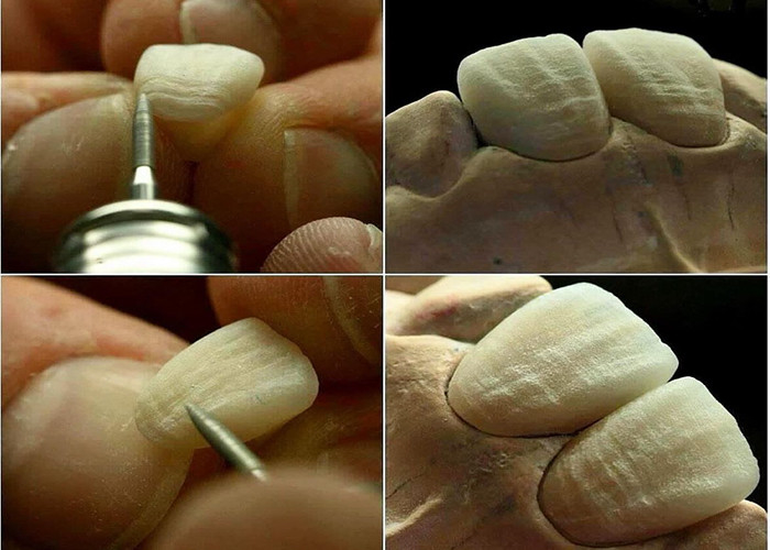 Resistente ao desgaste resistente à duração toda a ponte de coroa de cerâmica com excelente biocompatibilidade para restauração dental