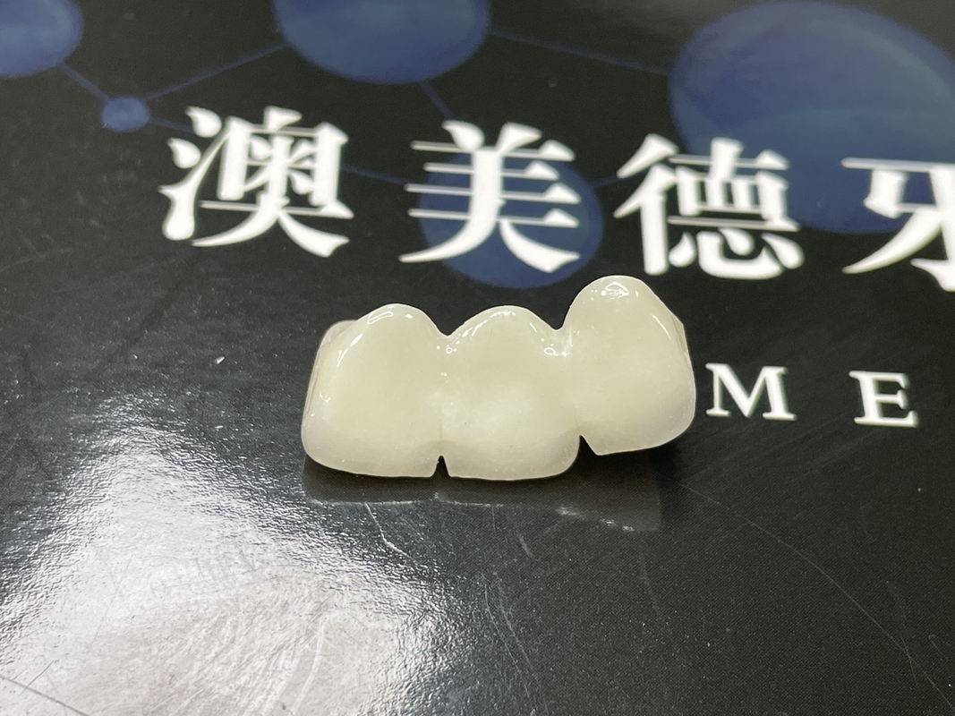Estética natural Coroas de cerâmica translúcidas para restauração dentária com limpeza fácil e resultados duradouros