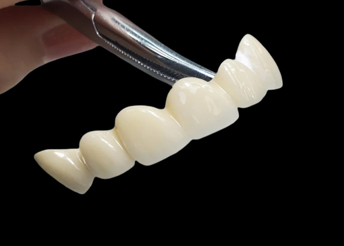 Coroa dental de zircônio translúcida personalizada com alta durabilidade resistente a manchas do laboratório dentário da China