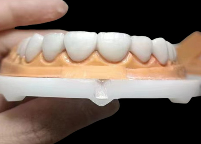 Coroa dental de zircônio translúcida personalizada com alta durabilidade resistente a manchas do laboratório dentário da China