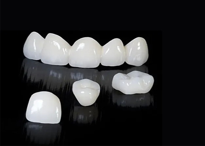 Coroa dental de zircônio translúcida personalizada com alta durabilidade resistente a manchas do laboratório dentário da China