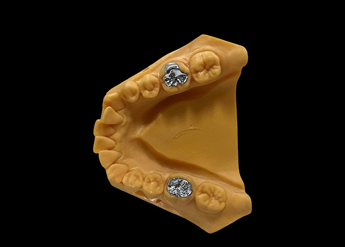 Porcelana fundida a metal PFM resistência ao desgaste dental da coroa para odontologia restaurativa