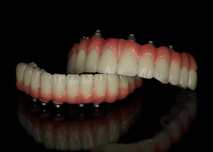 Proteção de base de titânio Implante fixo apoiado dentaduras com ponte de coroa de cerâmica Para substituir dentes ausentes