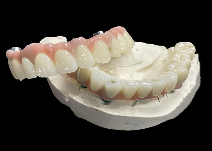 Proteção de base de titânio Implante fixo apoiado dentaduras com ponte de coroa de cerâmica Para substituir dentes ausentes