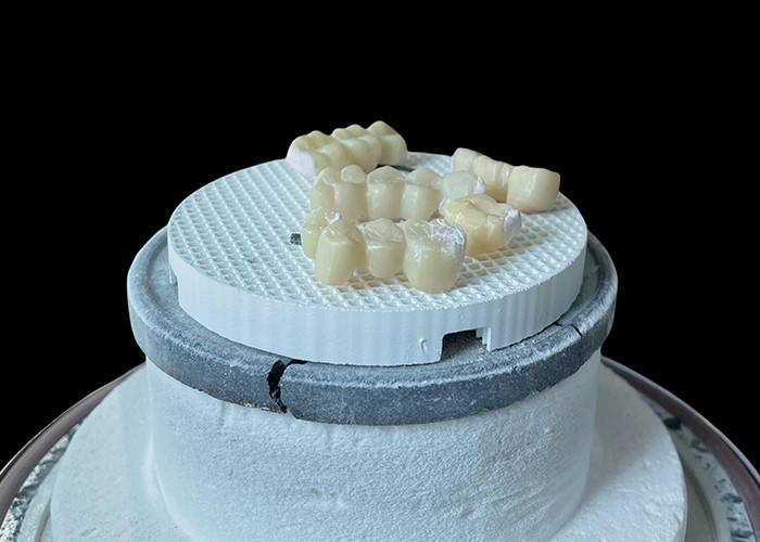 Confortável ponte dental de porcelana com construção totalmente cerâmica para resistência excepcional ao desgaste