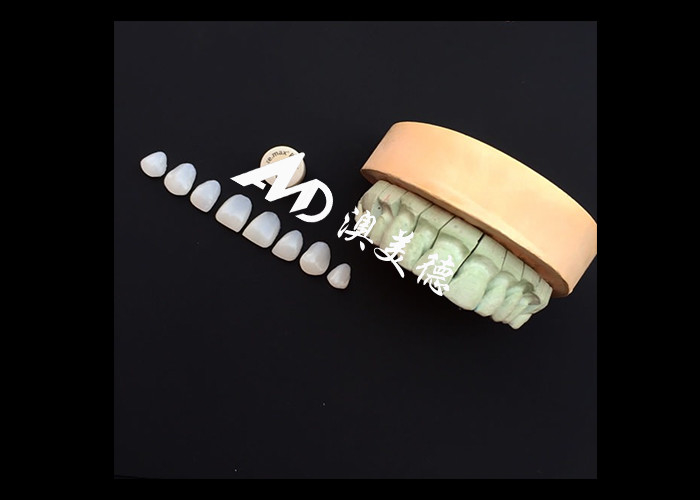 Transforme o seu sorriso com o IPS emax Pressa Veneers de porcelana Força Estética e durabilidade combinadas