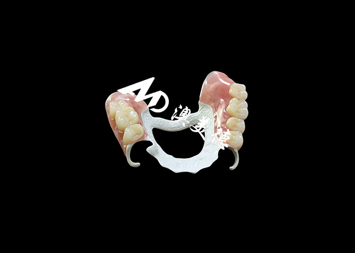 Dentadura removível com estrutura HPP e base acrílica para maior durabilidade e conforto