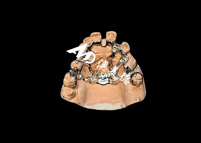 Dentadura removível com estrutura de metal fundido para superior força e estabilidade com conforto duradouro