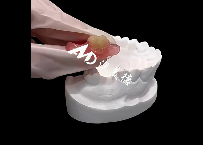 As próteses flexíveis Nesbite oferecem uma solução perfeita para um sorriso confortável e de aparência natural