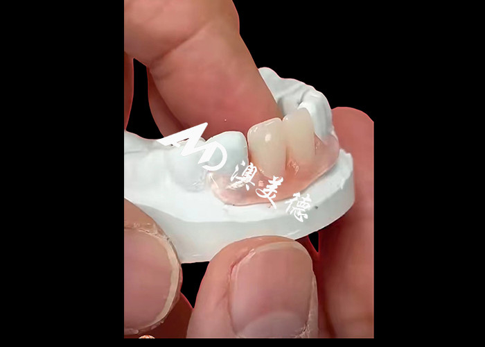 As próteses flexíveis Nesbite oferecem uma solução perfeita para um sorriso confortável e de aparência natural