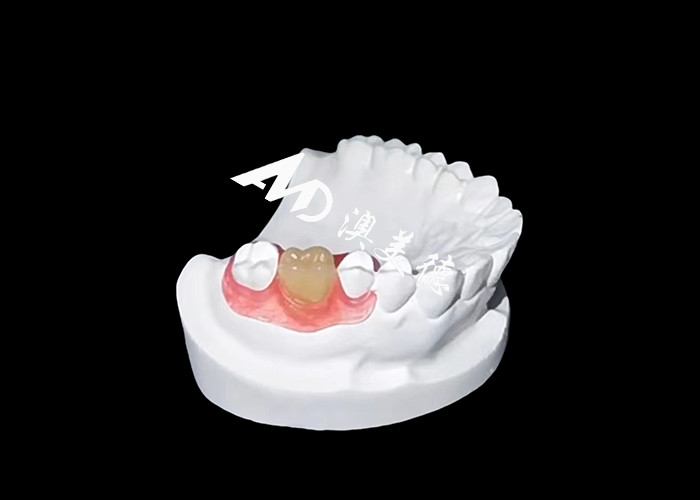 As próteses flexíveis Nesbite oferecem uma solução perfeita para um sorriso confortável e de aparência natural