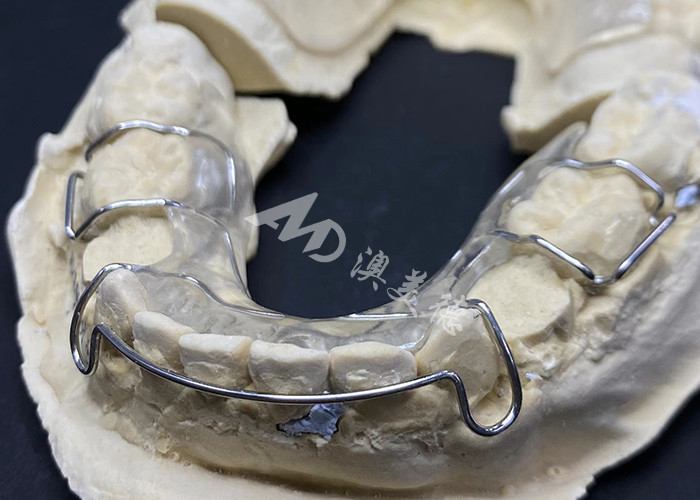 Confortável de usar o retentor Hawley do AMD Dental Lab para ortodontia segura e saudável