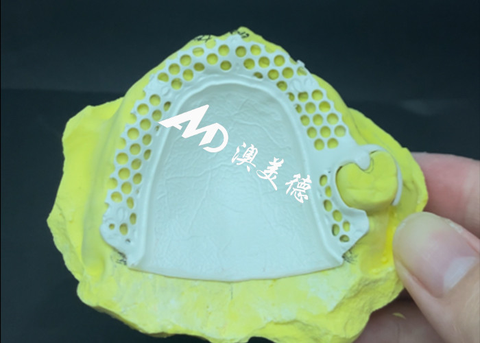 Quadro de Dentes Removíveis HPP Custom Fit para ótimo conforto funcional e estética