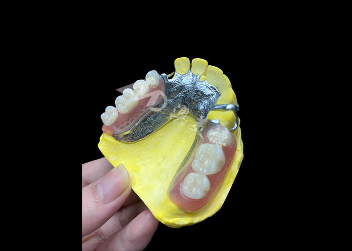 Dentes parciais moldados ajustáveis para maior conforto e estabilidade, perfeitos para mastigar e falar