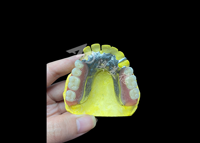 Dentes parciais moldados ajustáveis para maior conforto e estabilidade, perfeitos para mastigar e falar
