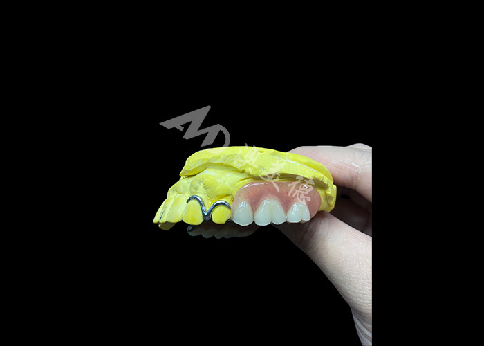 Dentes parciais moldados ajustáveis para maior conforto e estabilidade, perfeitos para mastigar e falar