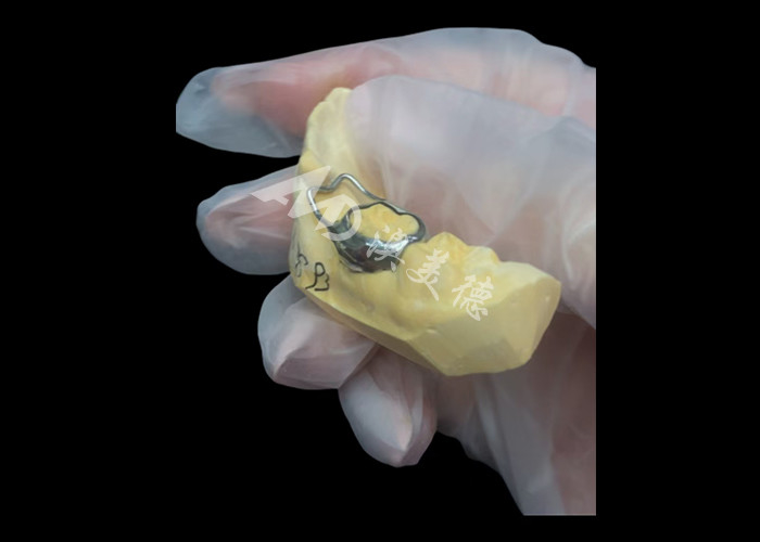 O mantentor de espaço ortodôntico é um dispositivo inestimável que protege engenhosamente as lacunas dentárias das crianças, garantindo o desenvolvimento adequado dos dentes.