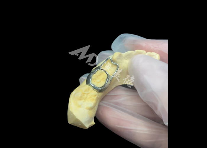 O mantentor de espaço ortodôntico é um dispositivo inestimável que protege engenhosamente as lacunas dentárias das crianças, garantindo o desenvolvimento adequado dos dentes.