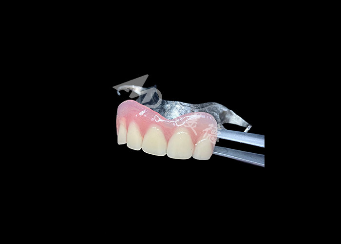 Dentes parciais fundidos de longa duração Manutenção fácil para melhor mastigação e sorriso perfeito