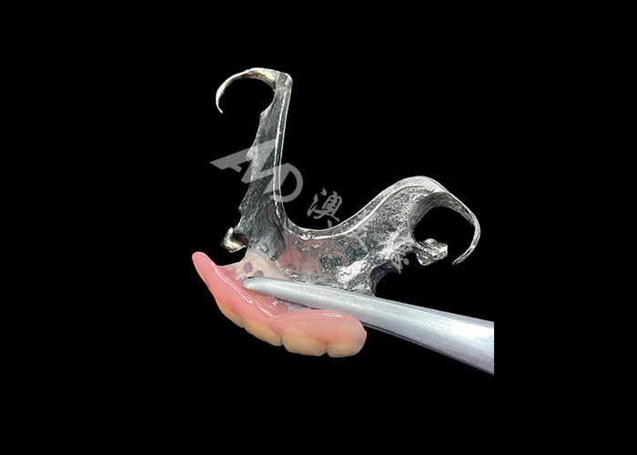 Dentes parciais fundidos de longa duração Manutenção fácil para melhor mastigação e sorriso perfeito