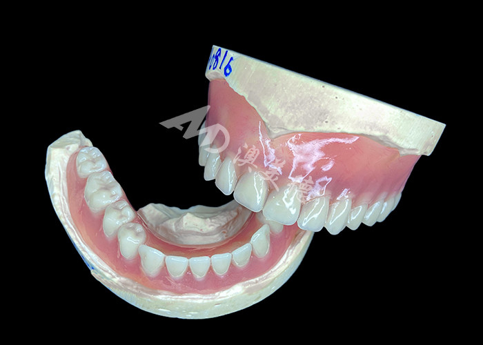 Dentes parciais de fundição personalizada, fáceis de limpar, ideais para restaurar a capacidade de mastigar e sorrisos