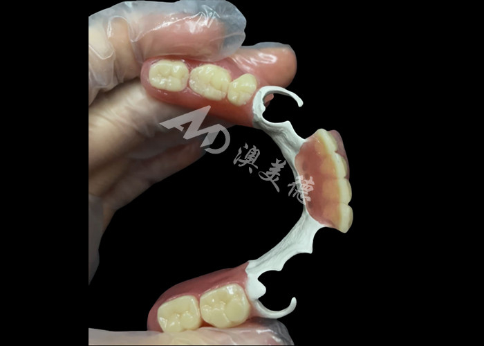 Dentes parciais de fundição duráveis feitos sob medida com estrutura HPP para restaurar o seu sorriso