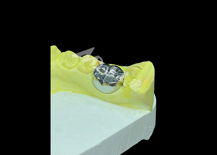 Função duradoura Coroa fundida de metal durável para restauração de dentes superior
