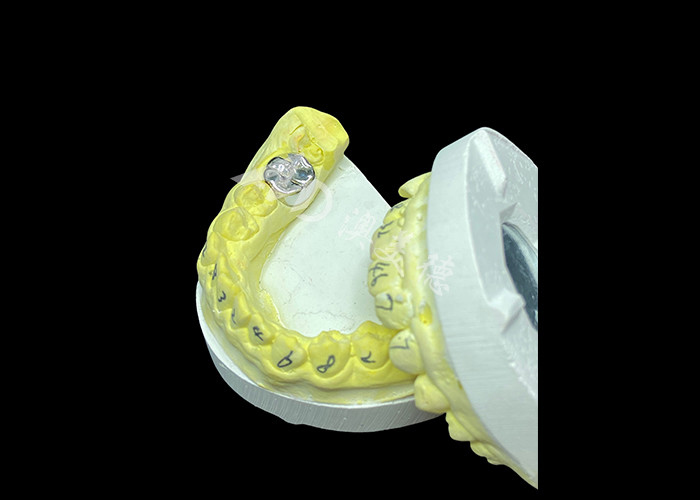 Função duradoura Coroa fundida de metal durável para restauração de dentes superior